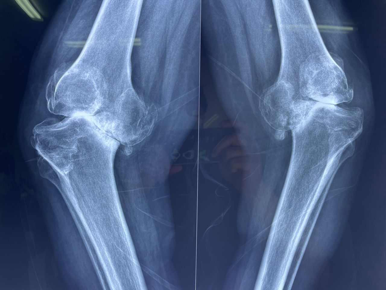 Carlos Tariacuri Valencia Aviles-19