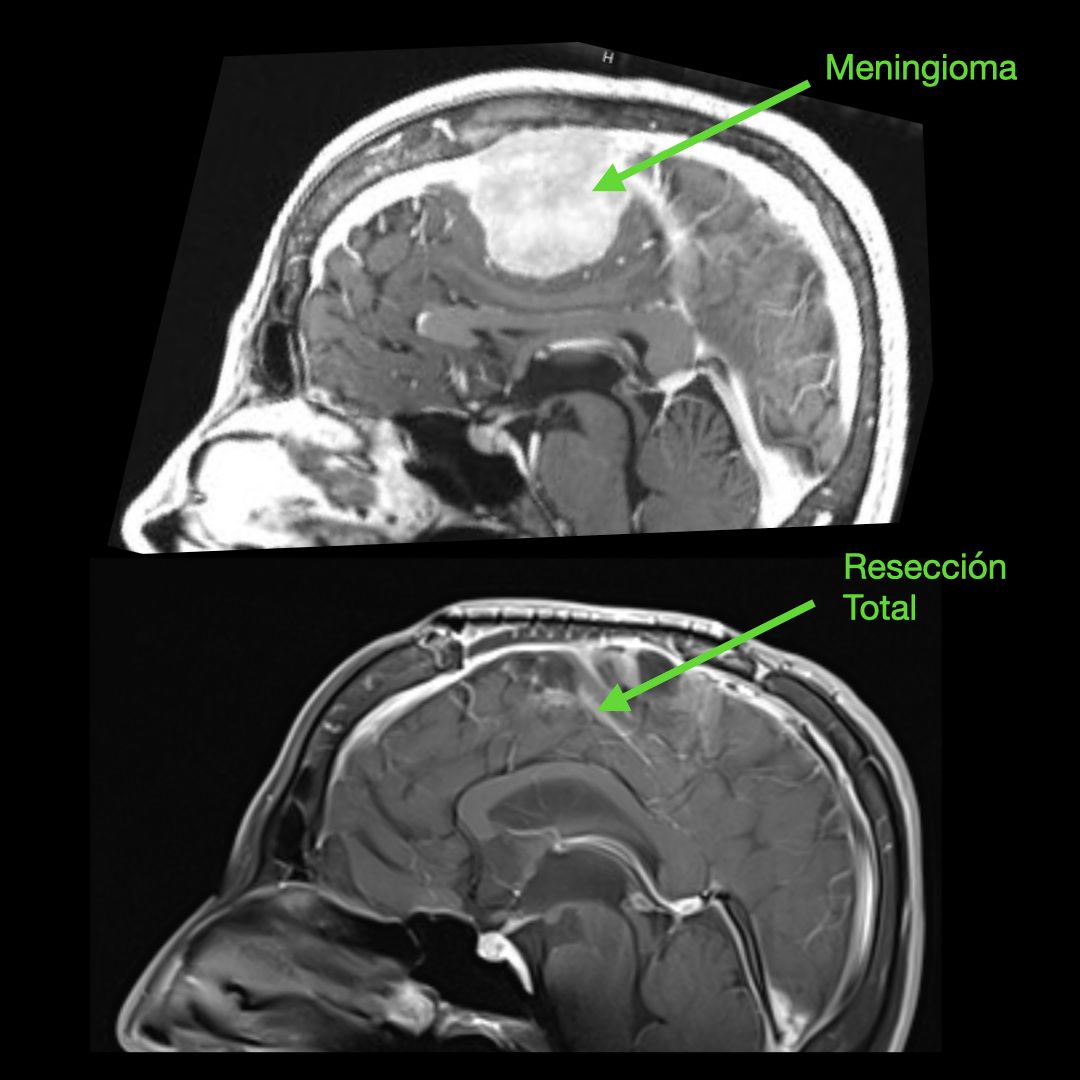 José De Jesús Martínez Manrique-3