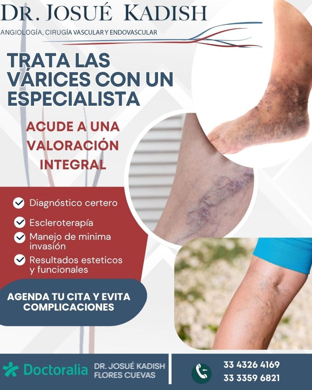 Josue Kadish Flores Cuevas-8