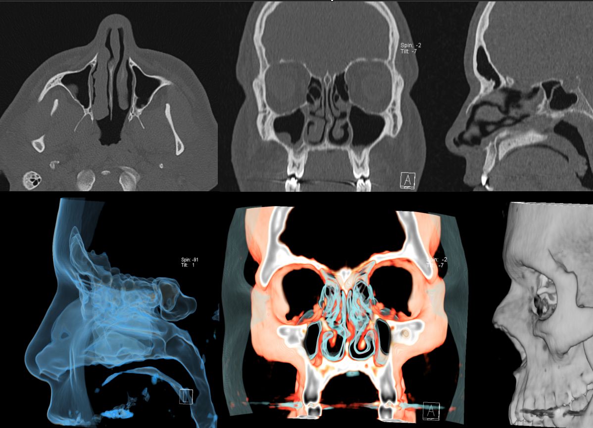 Nicolás Serrano Heredia-1