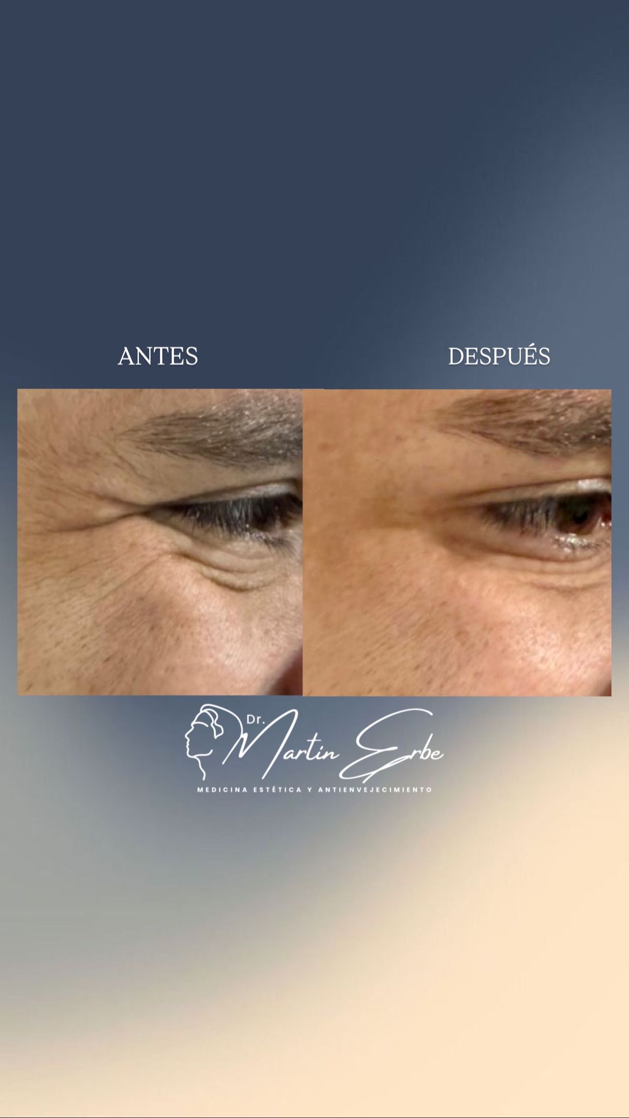 Martin Medina Erbe-12