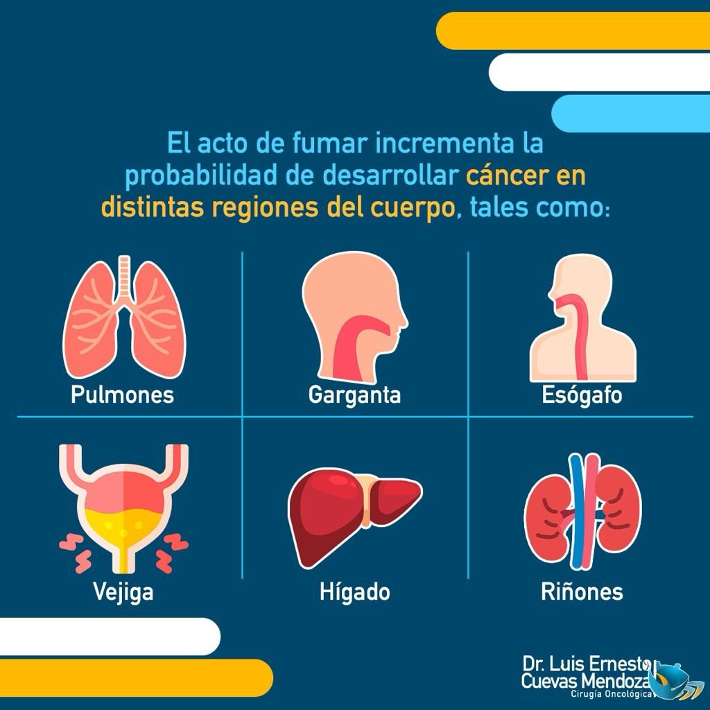 Luis Ernesto Cuevas Mendoza-64