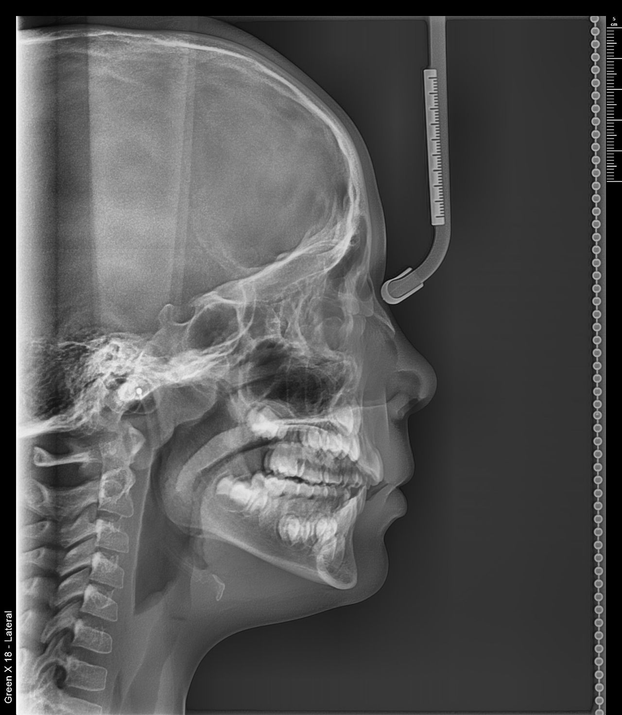 Pedro Badial Aceves-7