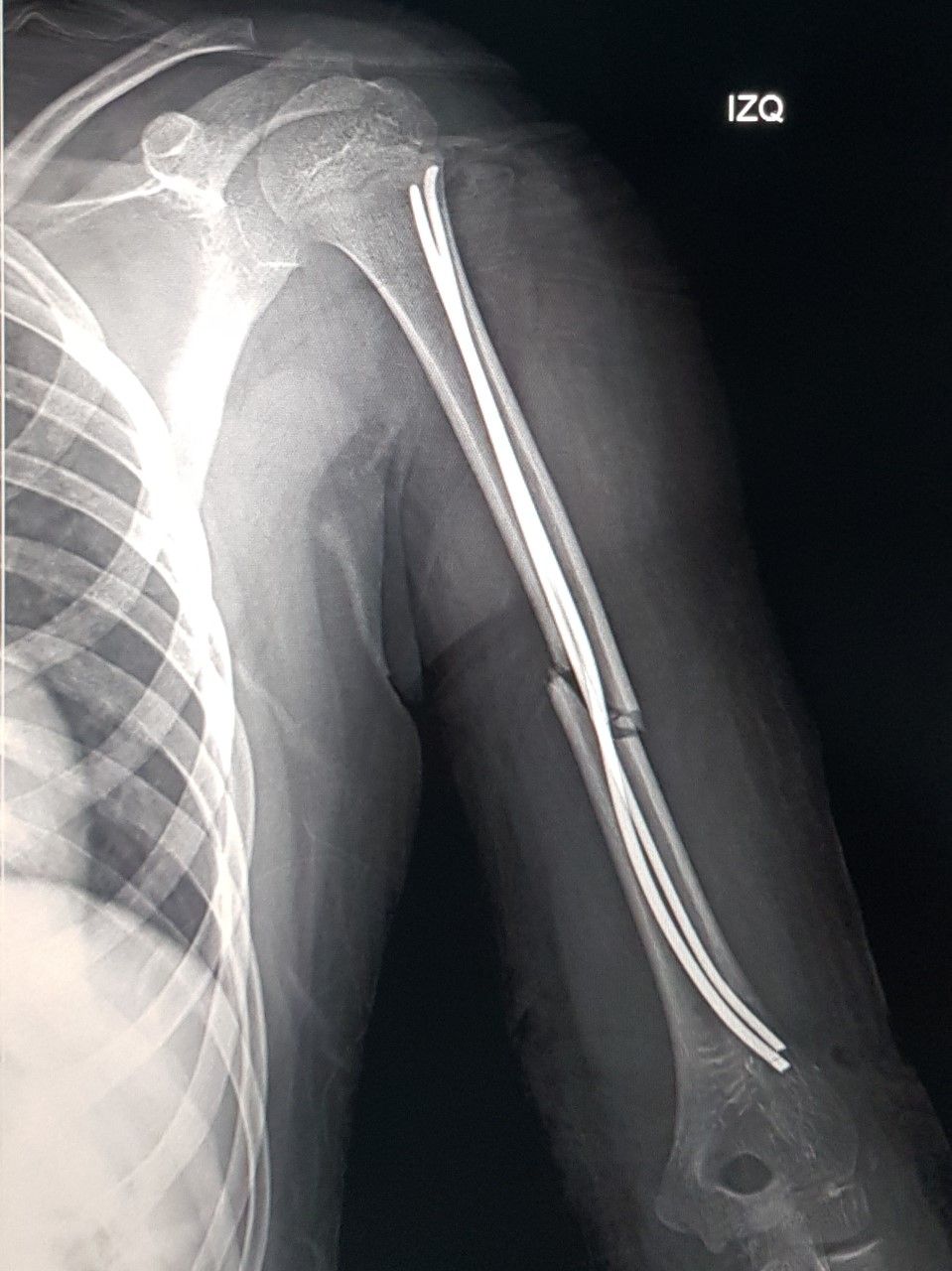 Gilberto Hernández Ortega-43