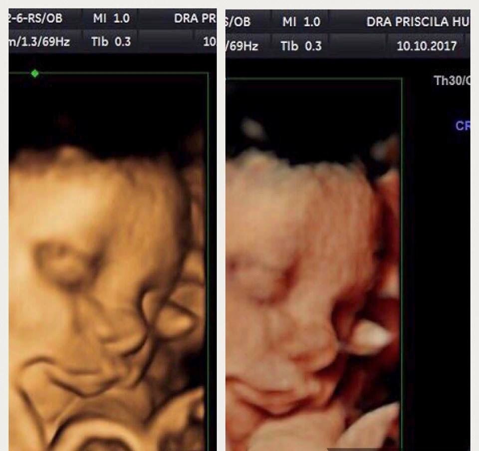 Priscila Hurtado Silvas-5