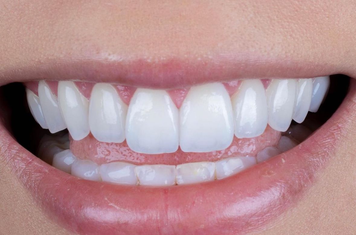 Ricardo Rosado Zamora-16