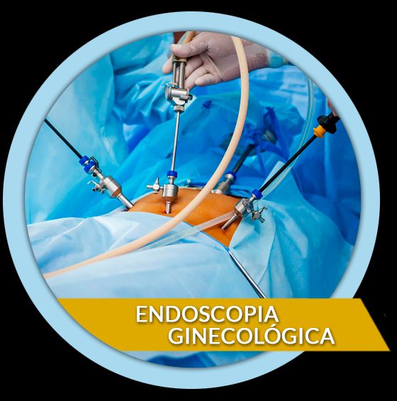 Denisse Valle Rojas-7