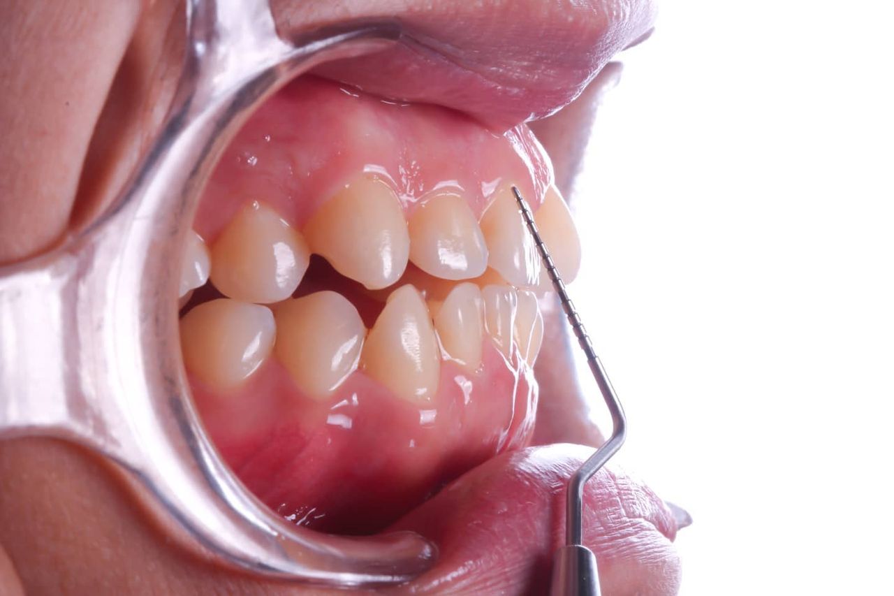 Hugo Enrique Aguilar Lamas-105