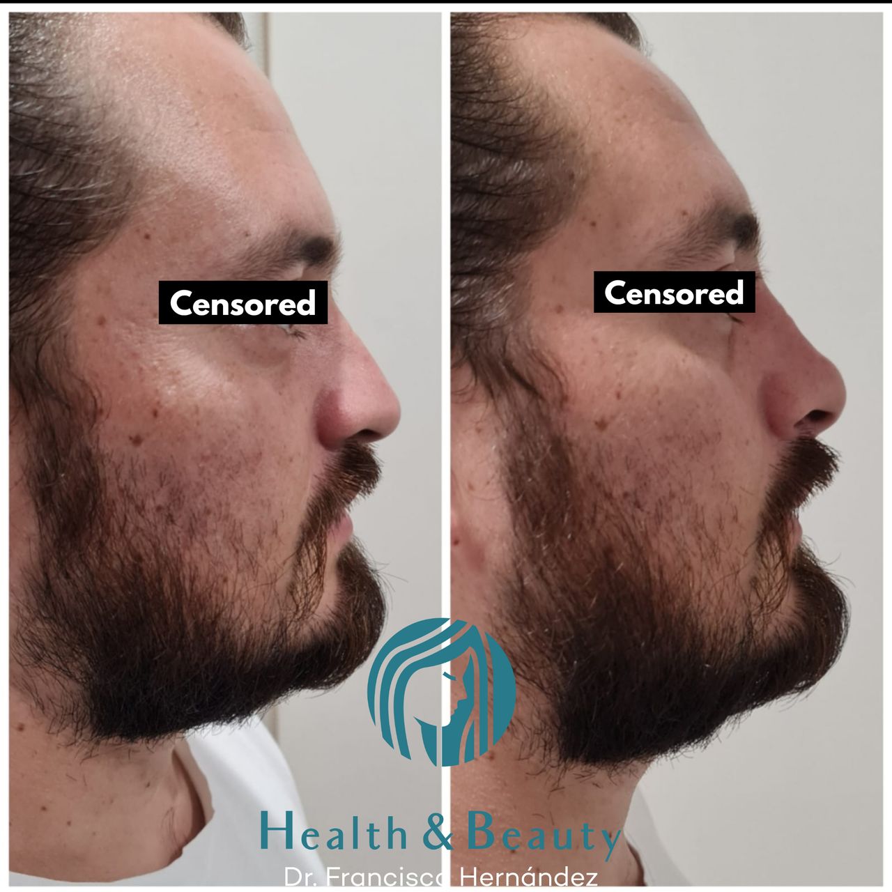 Francisco Hernández Gómez Crespo-88