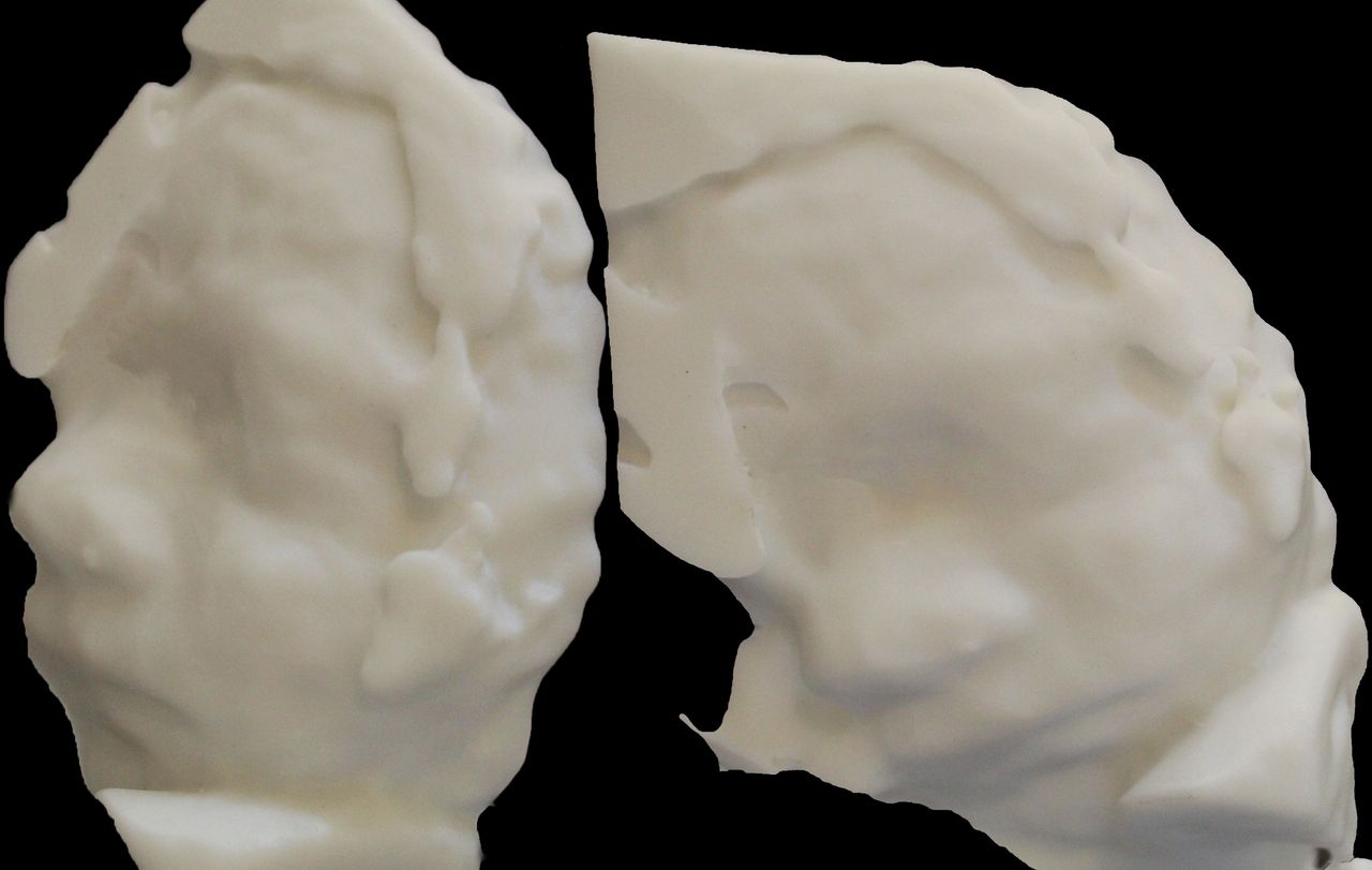 Raul Alejandro Patlan Montalvo-3