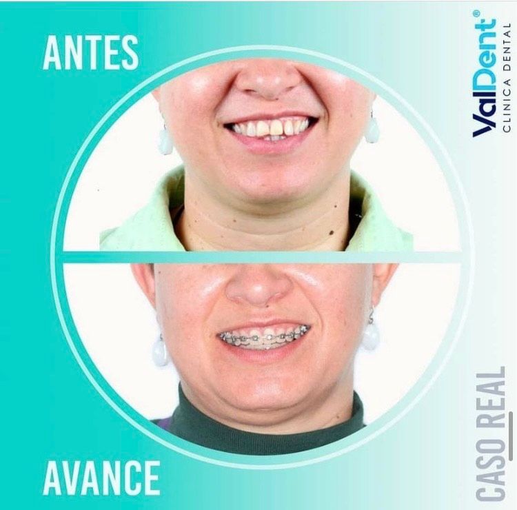 Karla Valdespino Gutierrez-10