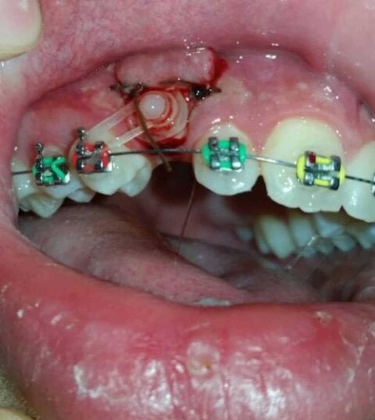 Rosa Isabel Lara Román-5