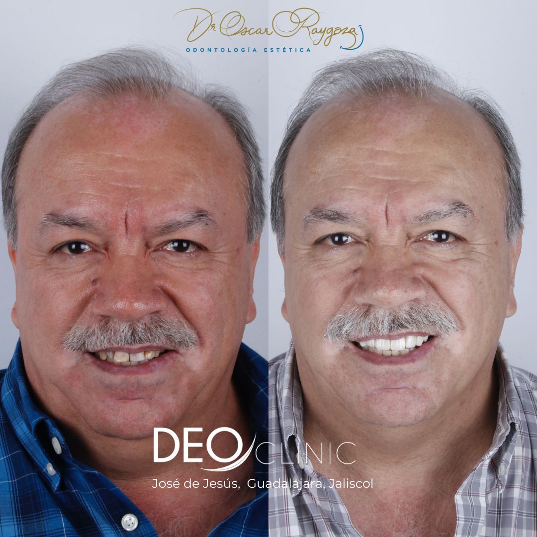 Oscar Raygoza Carrillo-52