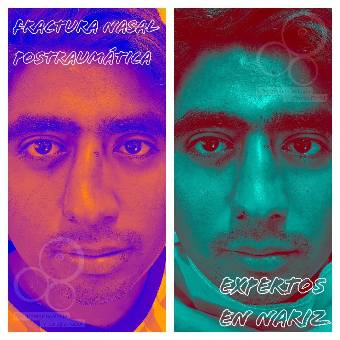 José Christian Ávila Romero-7