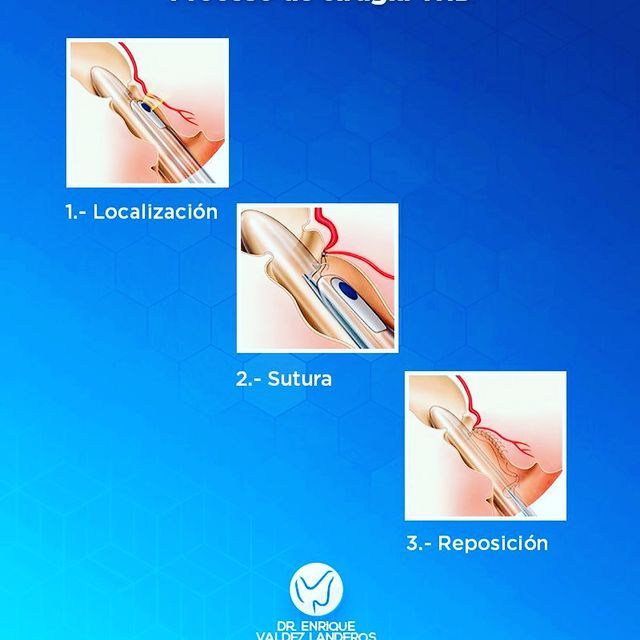 Enrique Valdez Landeros-2