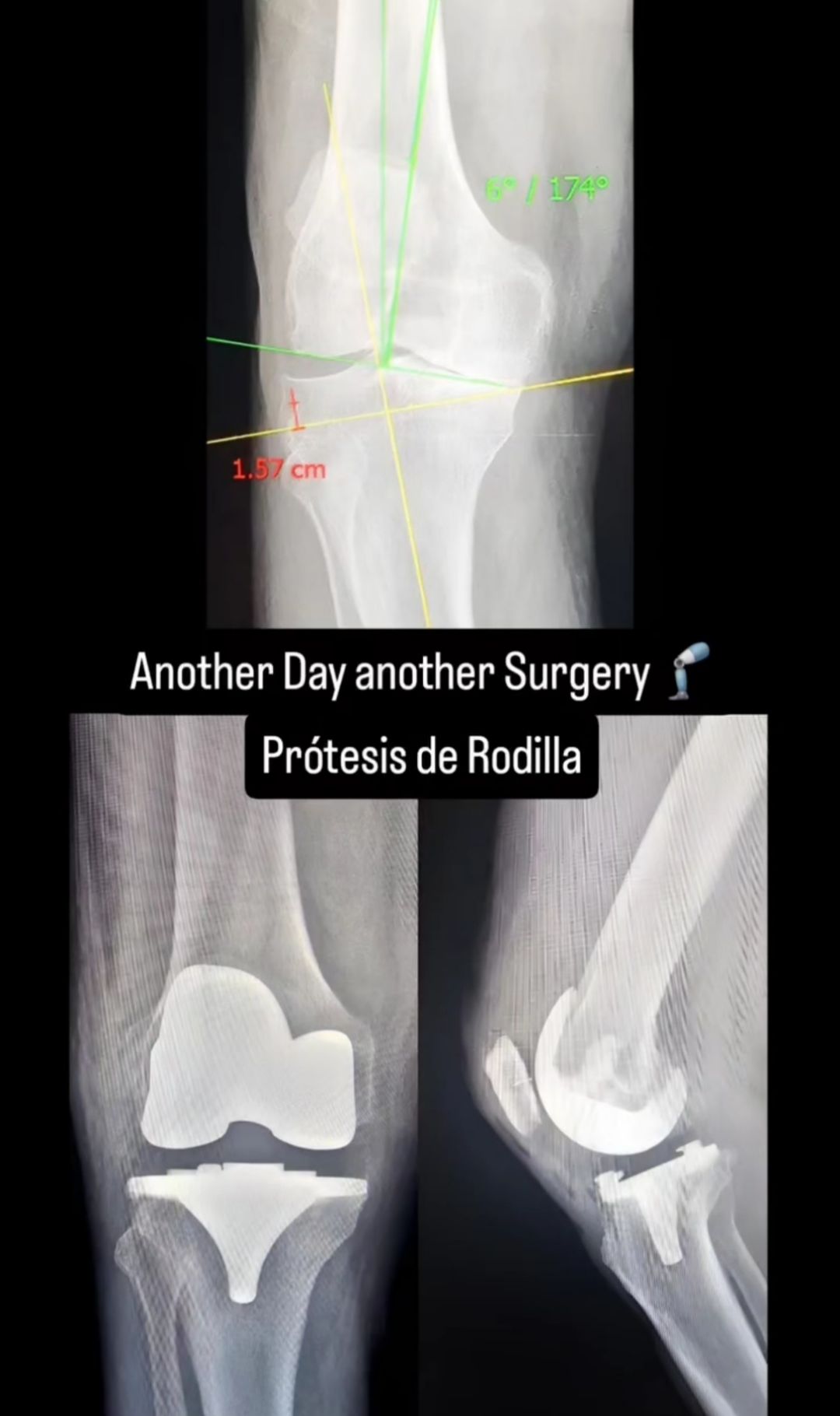 Noé Saavedra Islas-9