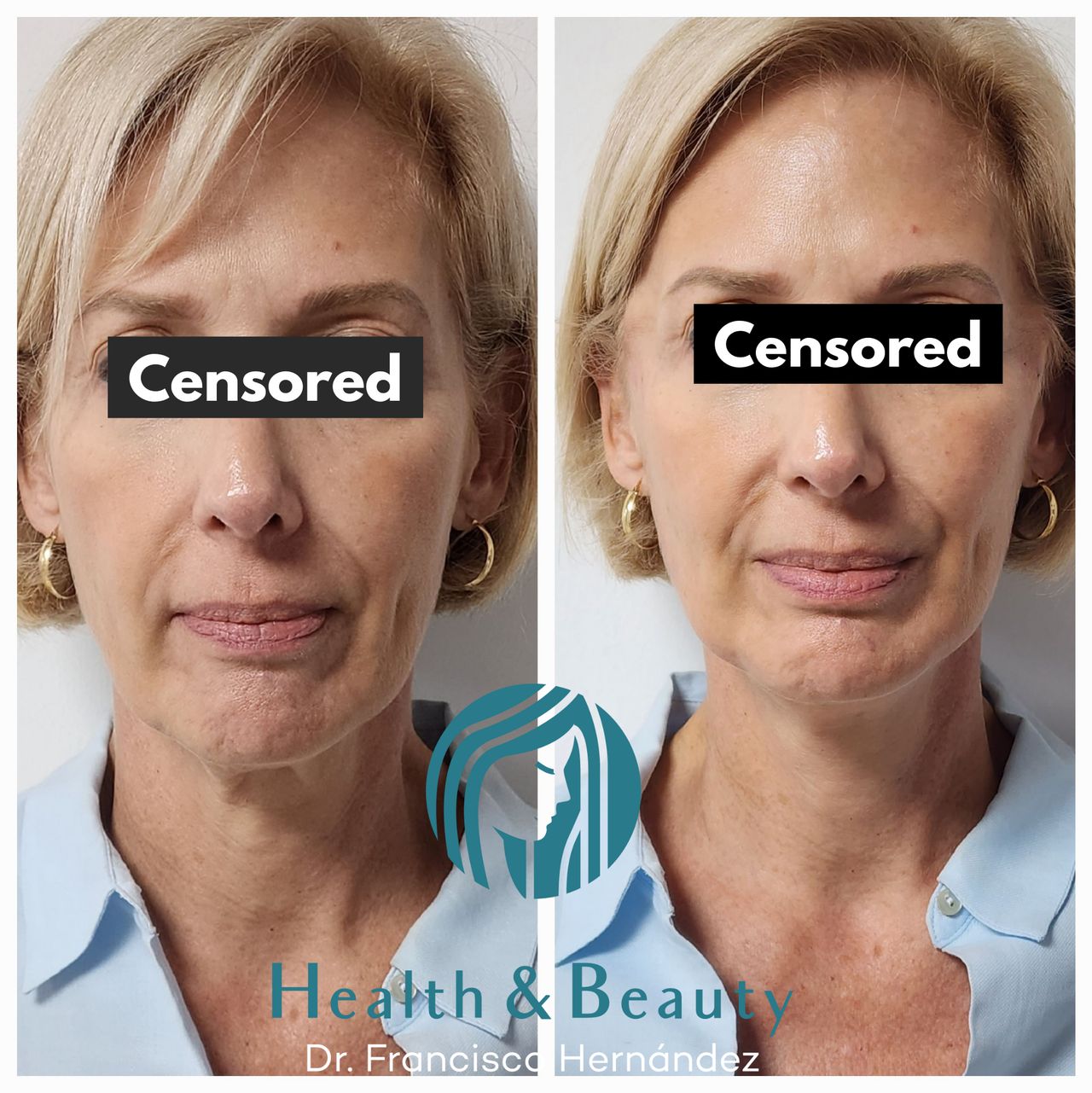 Francisco Hernández Gómez Crespo-55