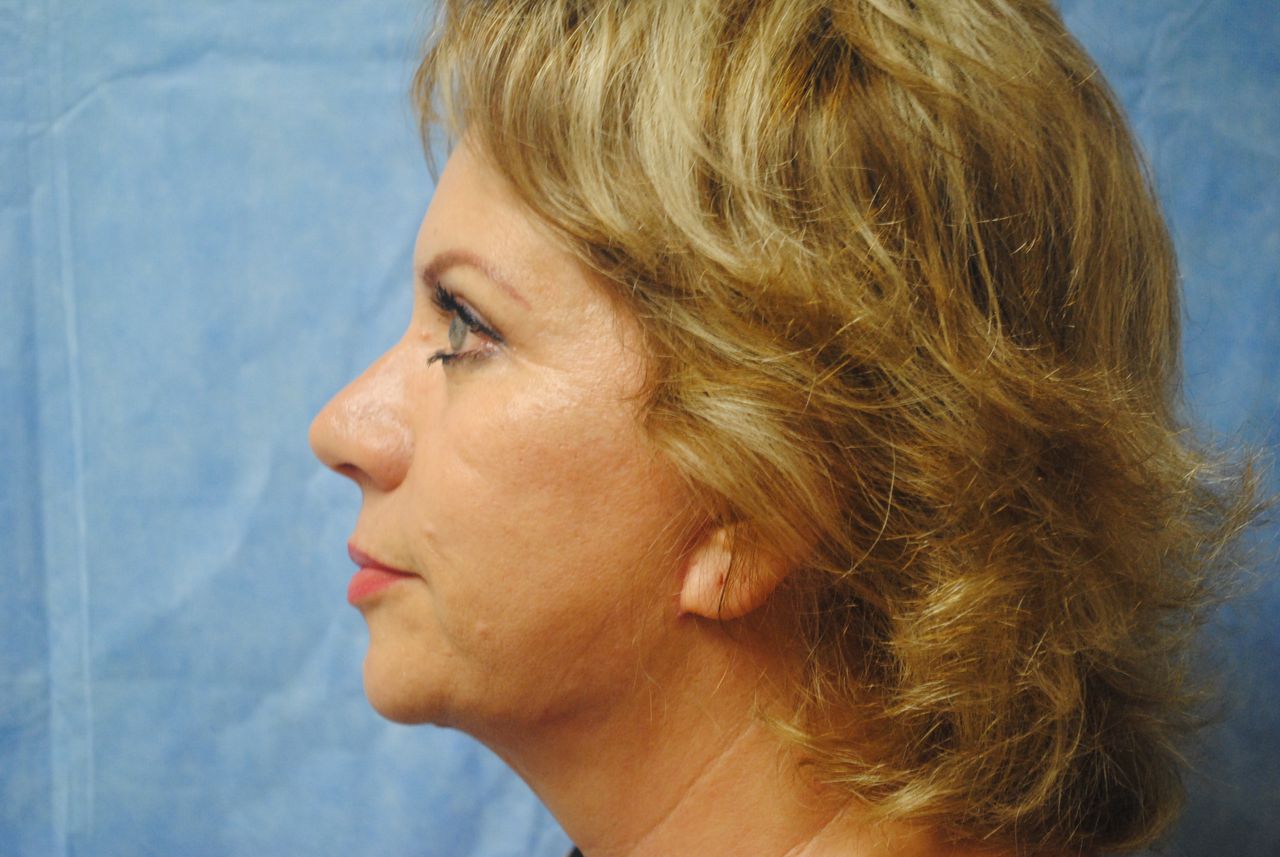 Ángel Dorador Ávila-3