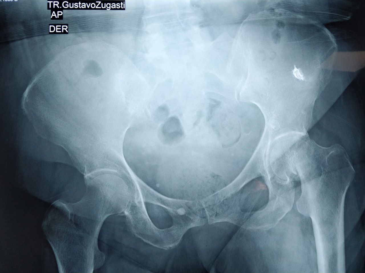 Christian Armando Mantecon Dominguez-7