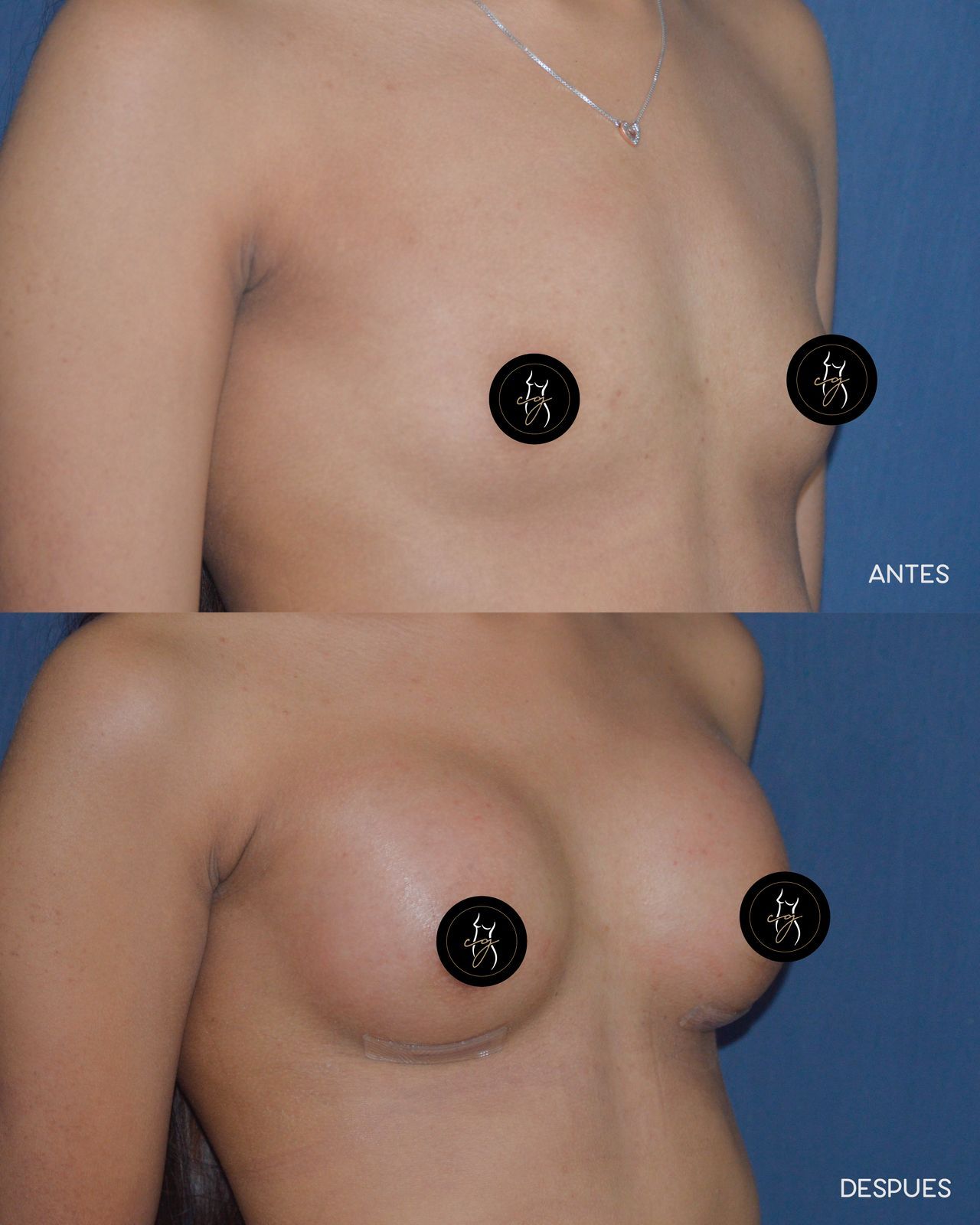 Carlos Alberto Gaitán García-5