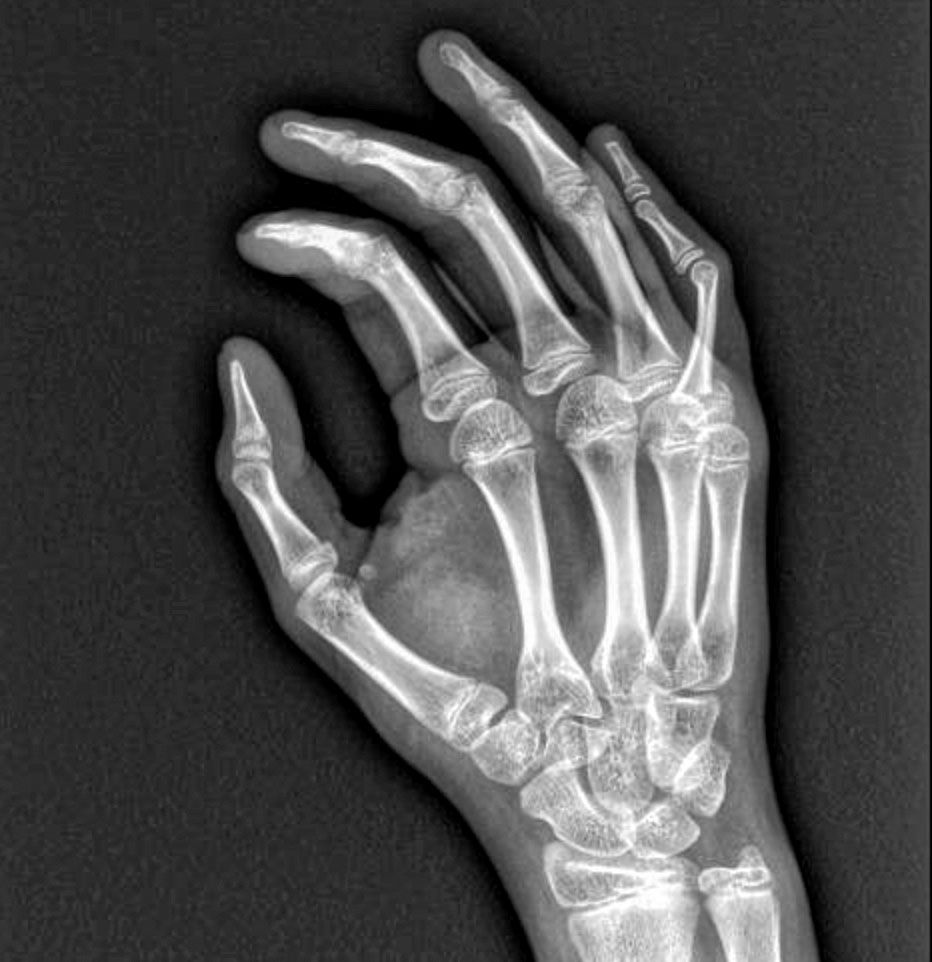 Oscar López Urrutia-9