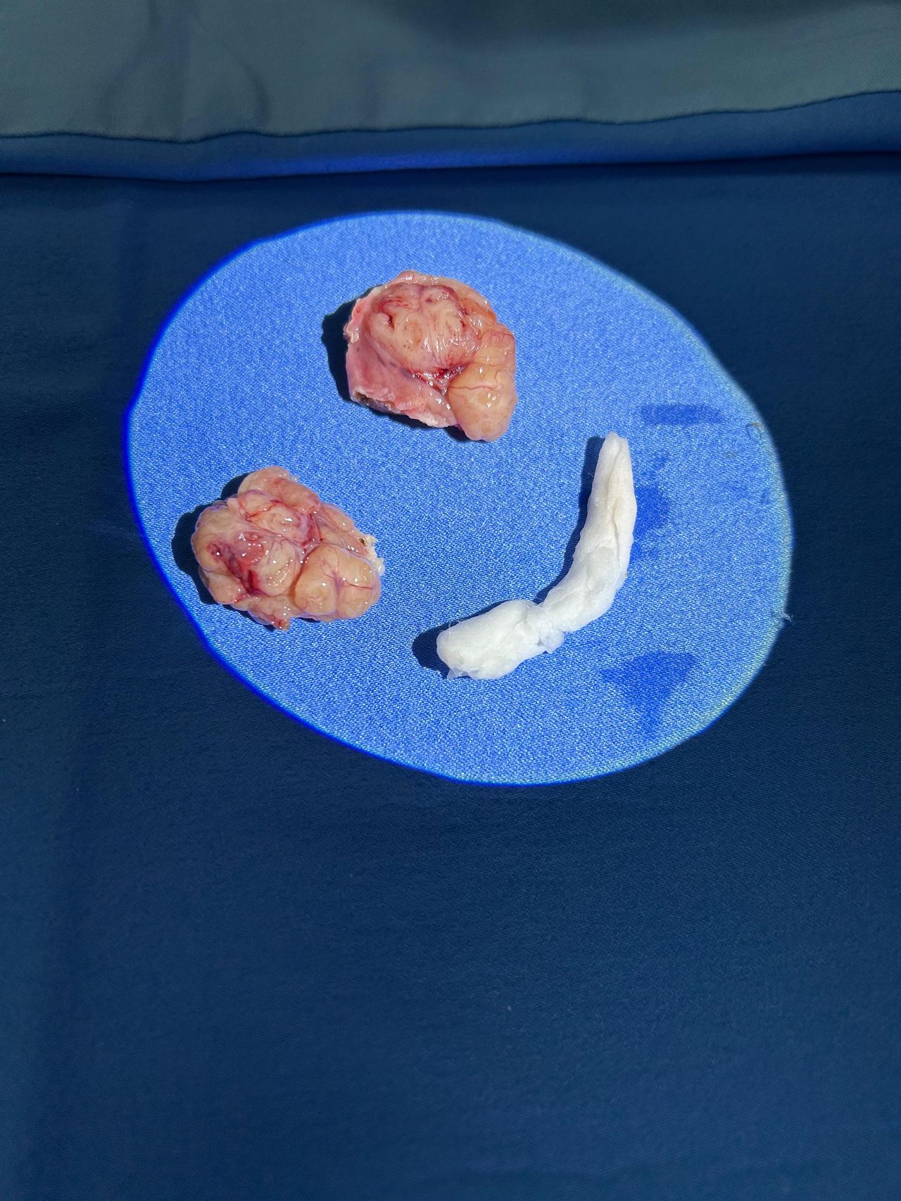 Abraham Hernández Mundo-13