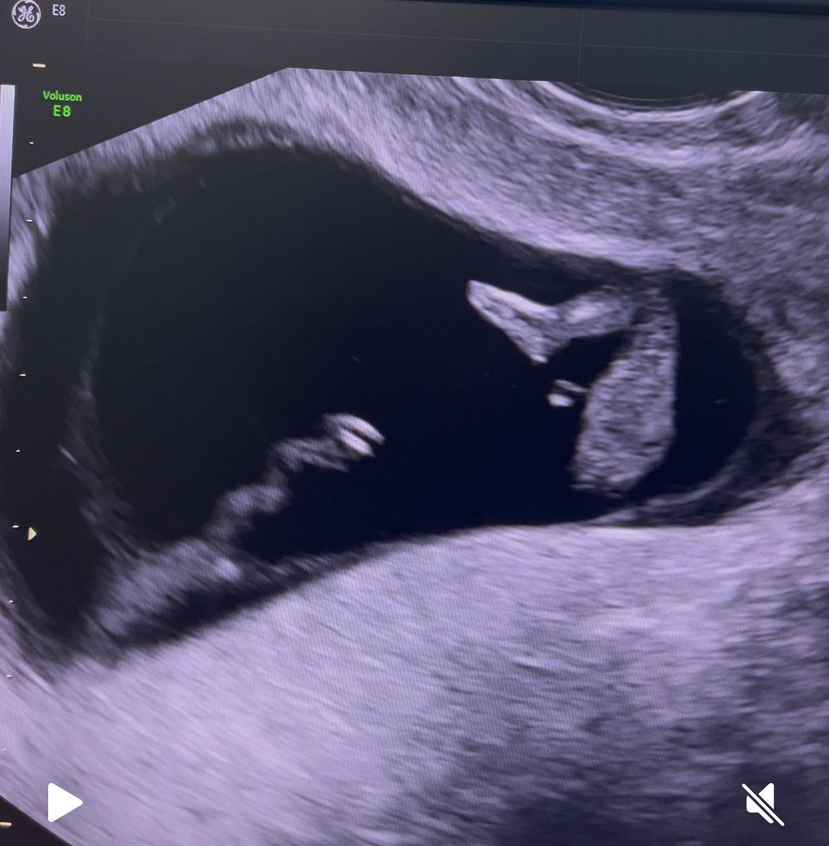 Gabriela Anaya Galindo-4