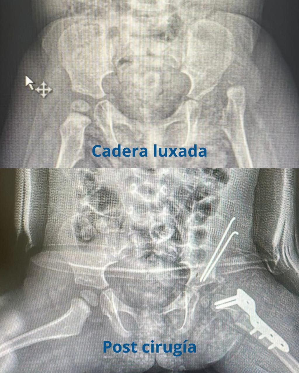 Lorena Baldini García-6