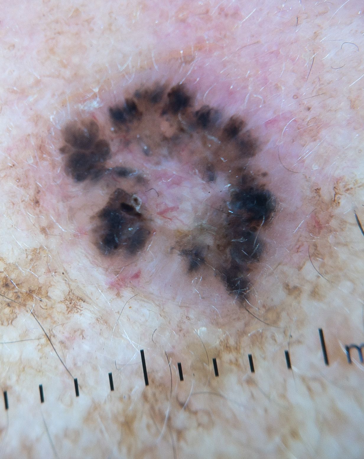 Lauro Francisco Varela Coronado-11