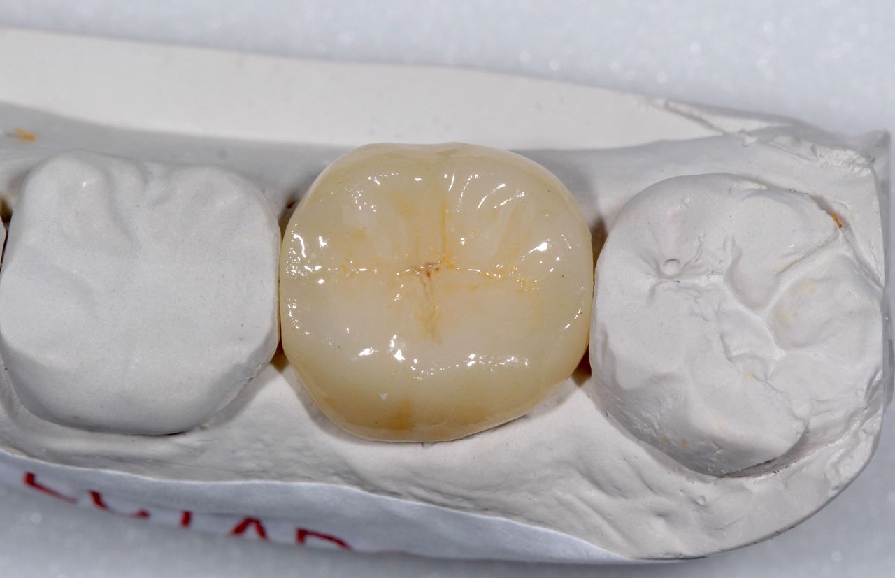 Jesus De La Cruz Ballinas-37