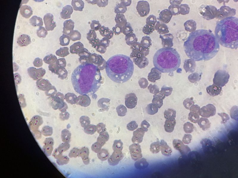 Abril Balam Canul-14