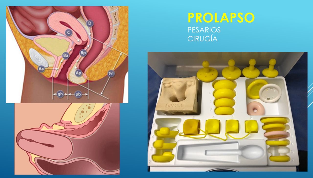 Jaime Cevallos Bustillos-6