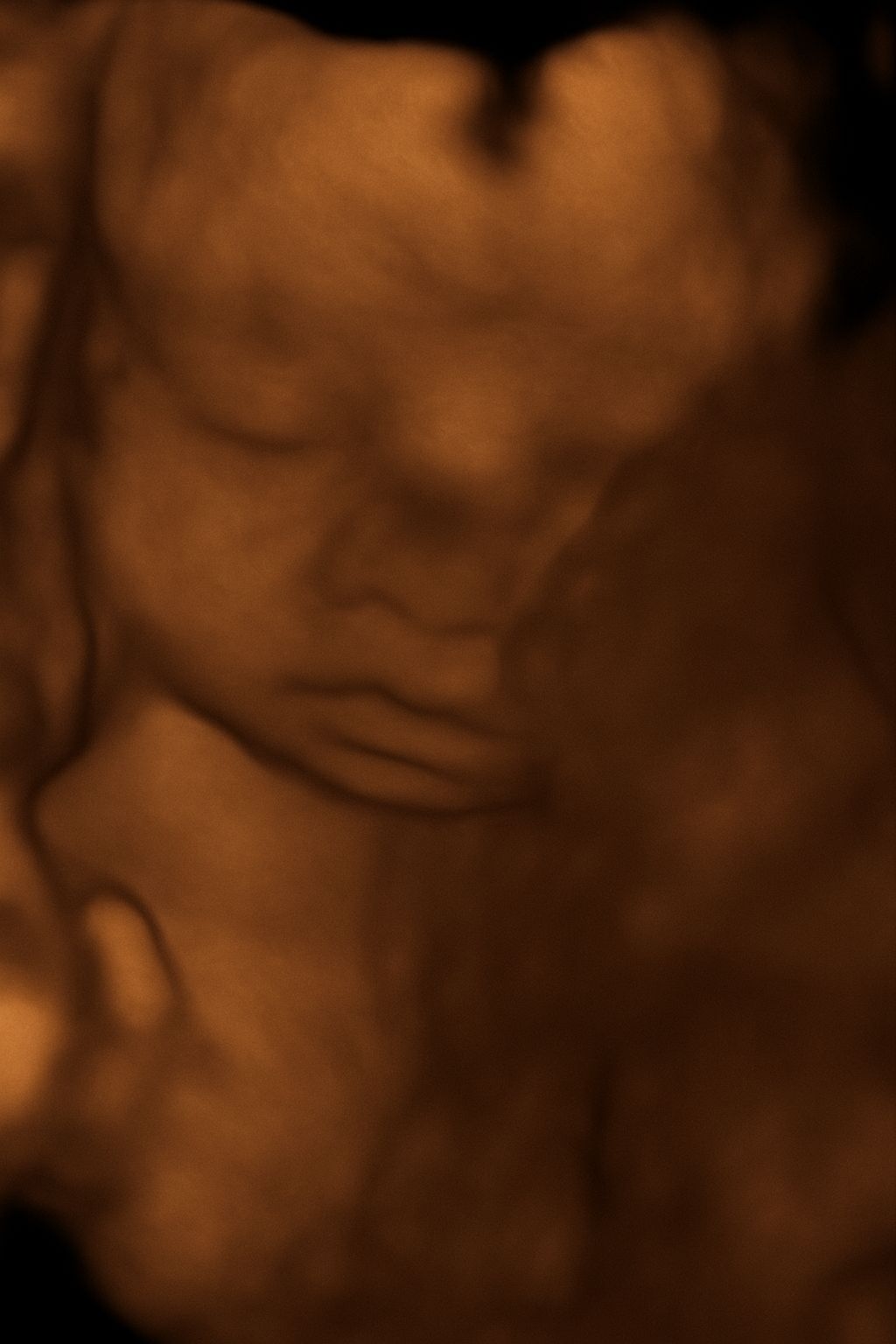 Adrian Estrada Campos-25