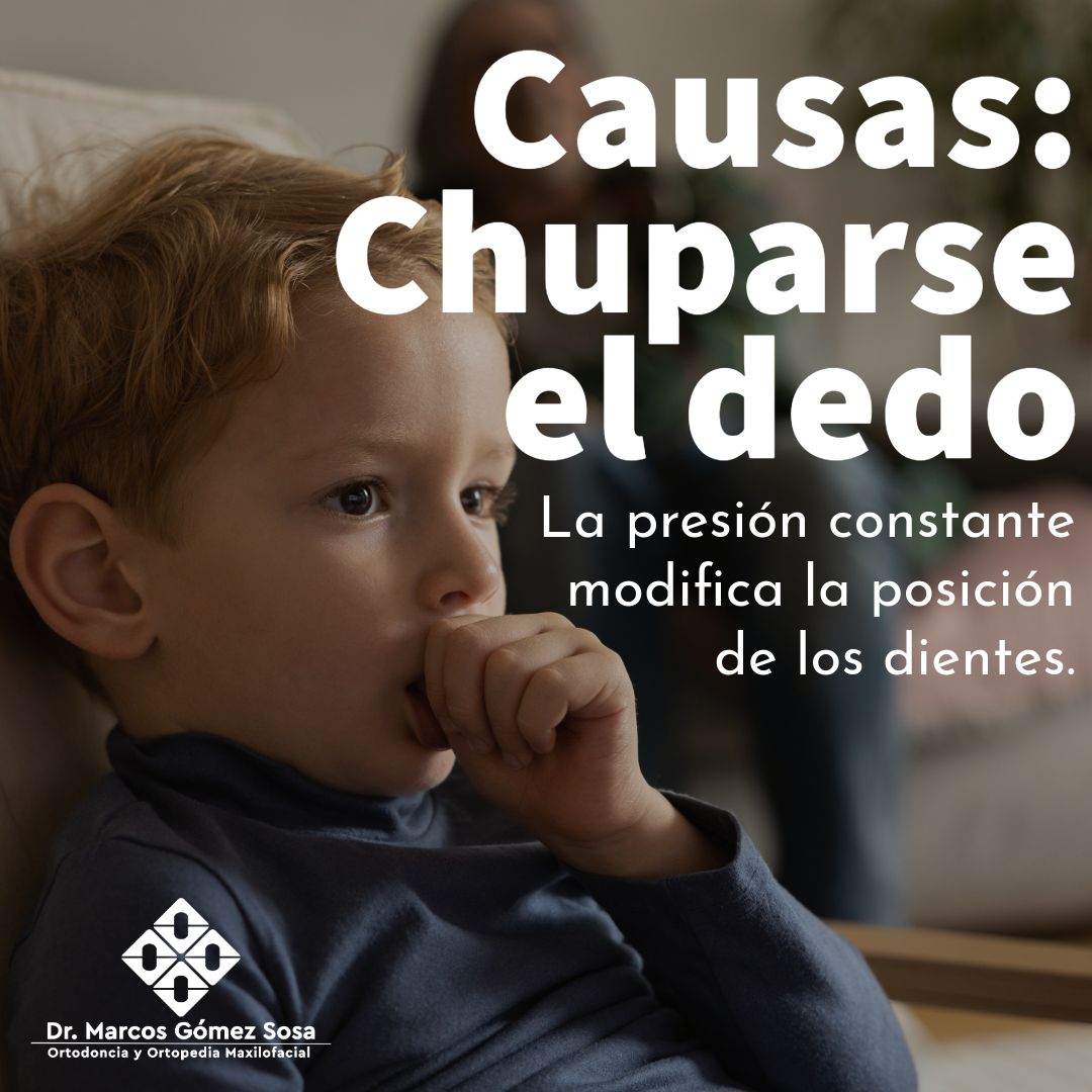 Marcos Gómez Sosa-44