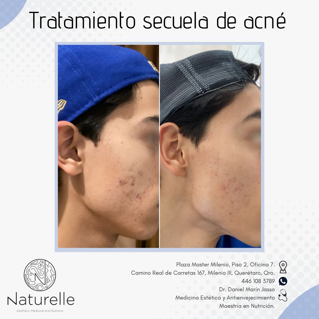 Daniel Marín Jasso-12