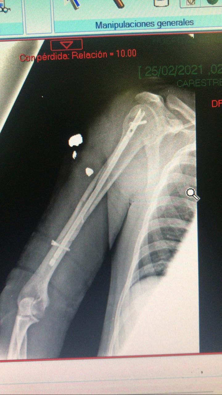 Juan José Luévano De La Cruz-46