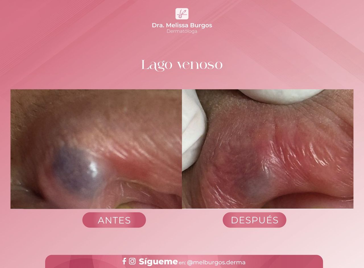 Melissa Burgos Romero-14