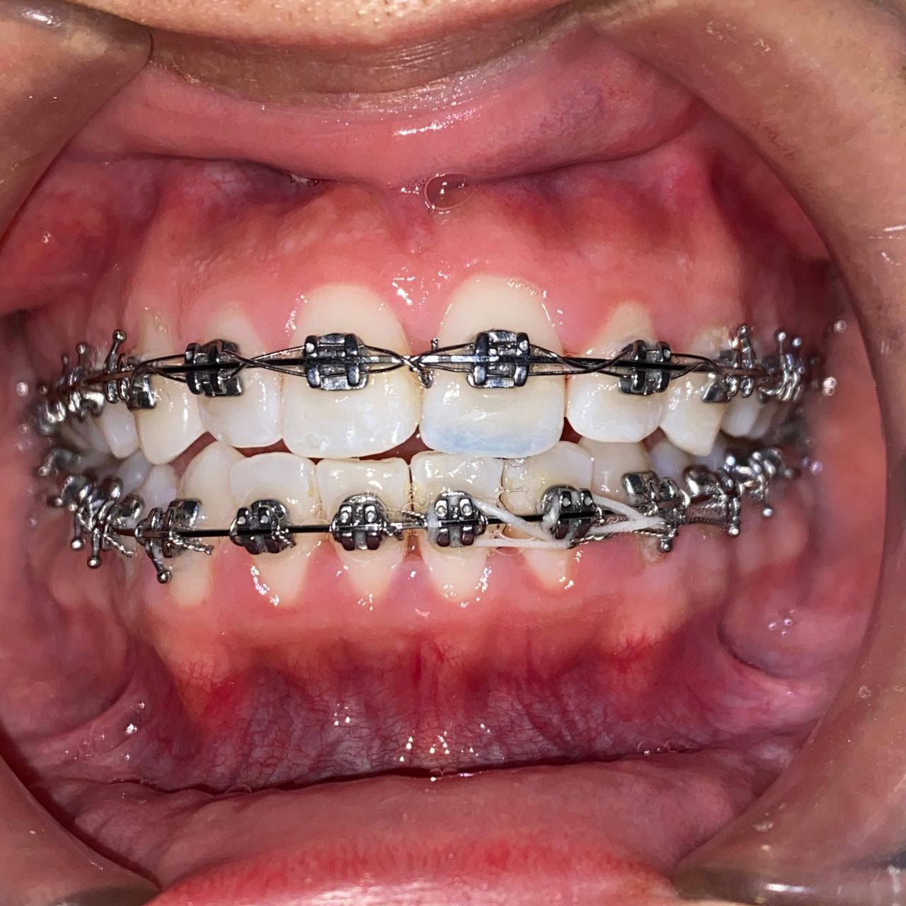 Raúl Méndez Cifuentes-17