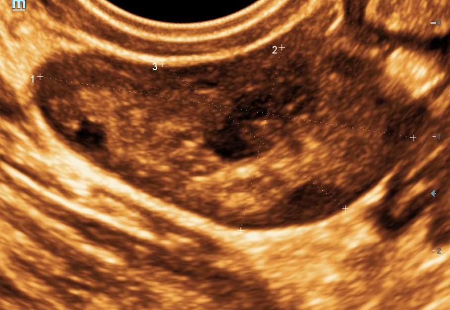 Ricardo Morales Velázquez-5