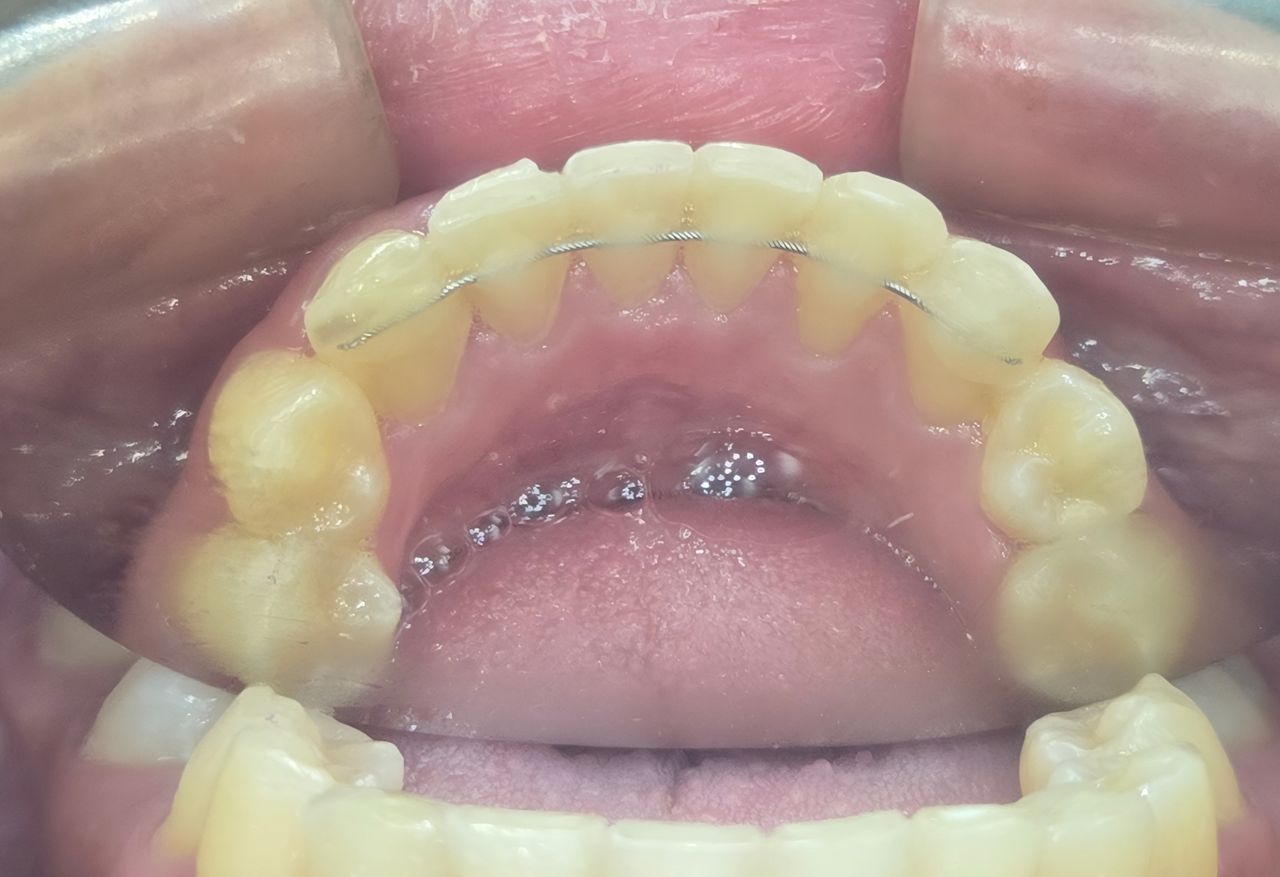 Edgardo Caballero Dávila-20