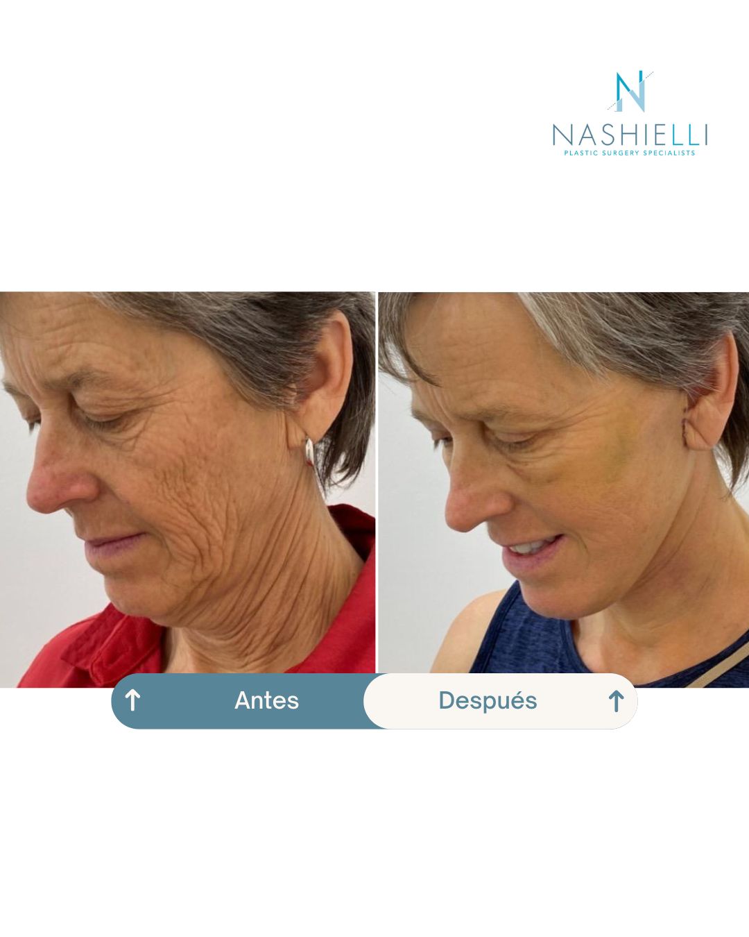 Nashielli Torres Espinosa Chiu-29