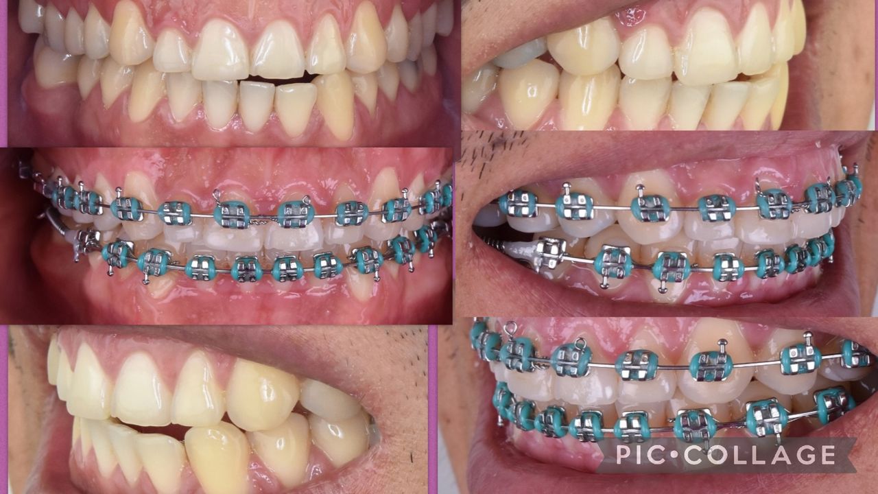 Fabiola Arcos Huesca-14