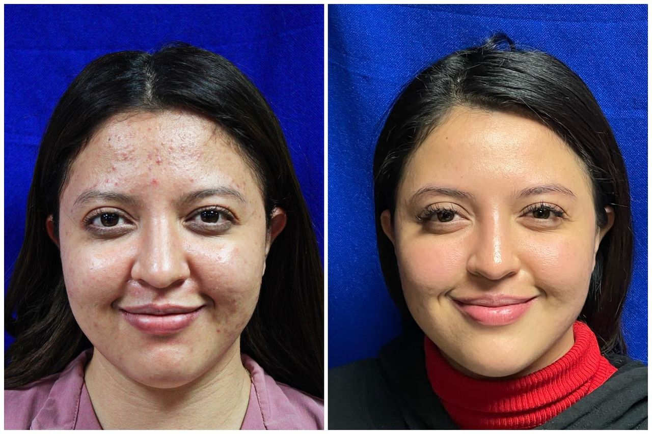 Adrián Martínez Moreno-8