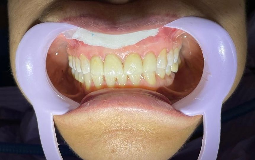 Martha Grissel Alcantar Camacho-20