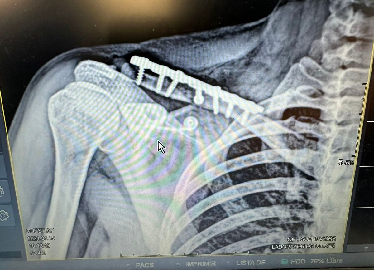 Nicole Alejandra Canales Romero-6