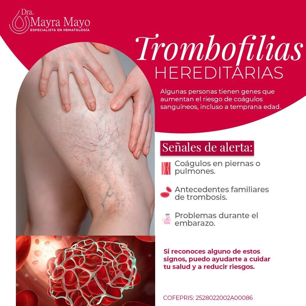 Mayra Lizbeth Mayo Martinez-17