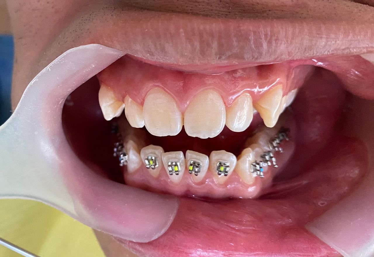 Analí García García-12