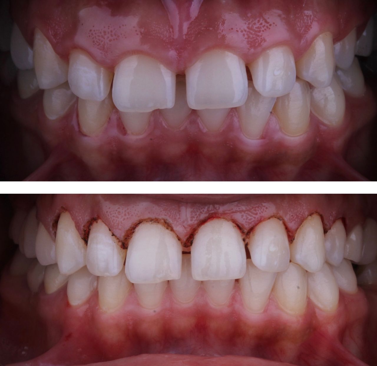 Josué Márquez Gómez-92