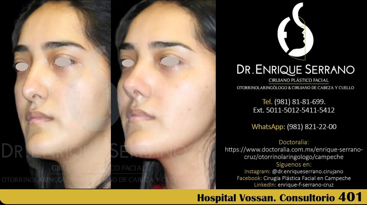 Enrique Serrano Cruz-95