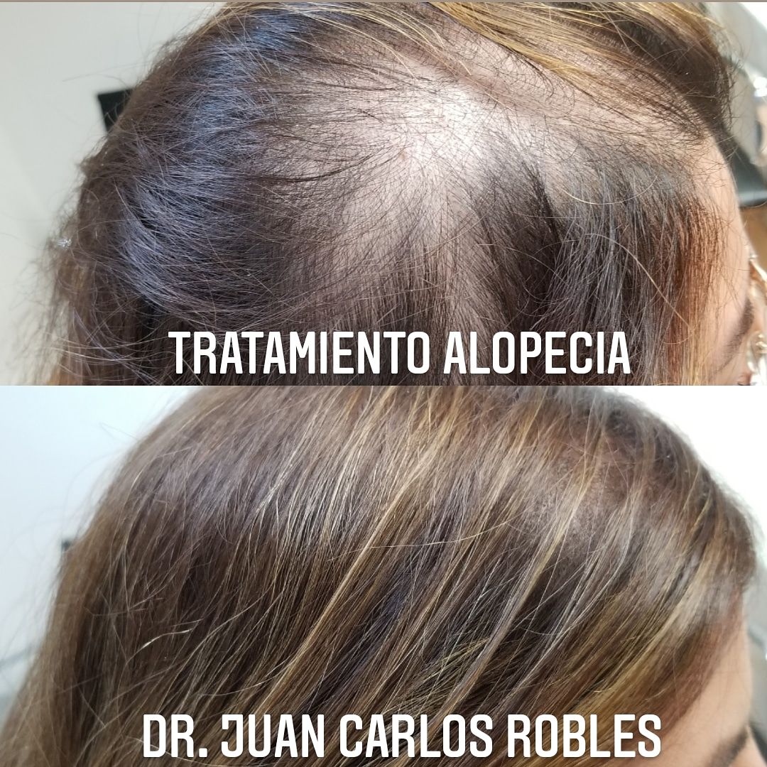 Juan Carlos Robles Méndez-1